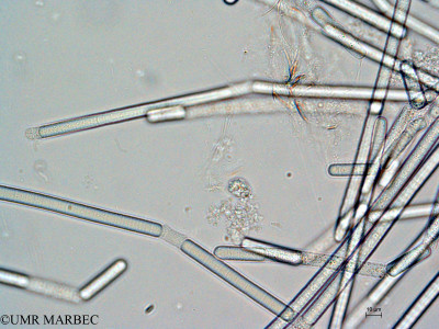 phyto/Mayotte/dziani/DZIANI 2007-2016/Nanoflagellé 4 (ancien Flagelle 1)(copy)_thumb.jpg